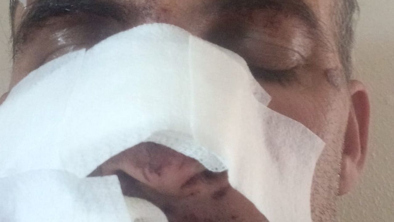 Eniştesine araçla çarpıp kaçtan şahıs tutuklandı