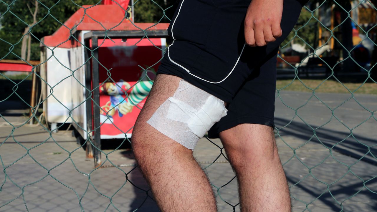 Parkta lise öğrencilerini döverek bıçaklayan şahıslar yakalandı