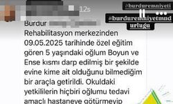 Rehabilitasyon Merkezinde 5 Yaşında Çocuğa Darp İddiası