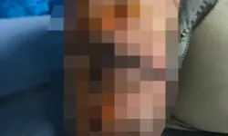 Yürüyüş yaparken köpek saldırısına uğradı