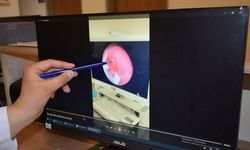 10 Aylık Bebeğin Nefes Borusuna Şeker Ambalajı Kaçtı