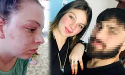 Milli Sporcu Eşinden Şiddet Gören Genç Kadın Konuştu