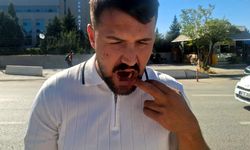 Ankara’da Taksiciye Saldırı: 4 Gözaltı