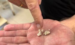 Antalya'da Tükürük Bezi Operasyonu