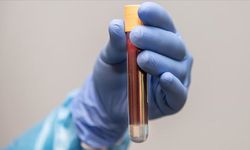 Ünlü o iki ismin uyuşturucu testi pozitif çıktı