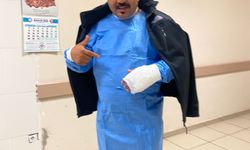 Soğuk hava testi yaparken yandı