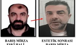 Ameliyat ile yüzünü değiştiren firari yakalandı!