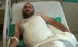 Çalışırken akıma kapılınca vücudunun 3'te 1'i yandı
