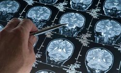 Yeni bir araştırma: Derin uyku Alzheimer'ı yavaşlatıyor