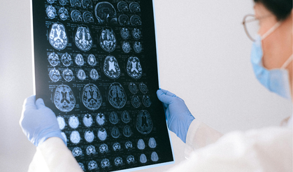 Glioblastoma ve Kemik Aşınması: Tümör Kafatasını Eritebilir mi?