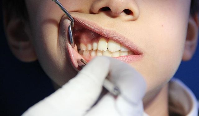 Yetersiz C vitamini Skorbüt hastalığına neden olabilir