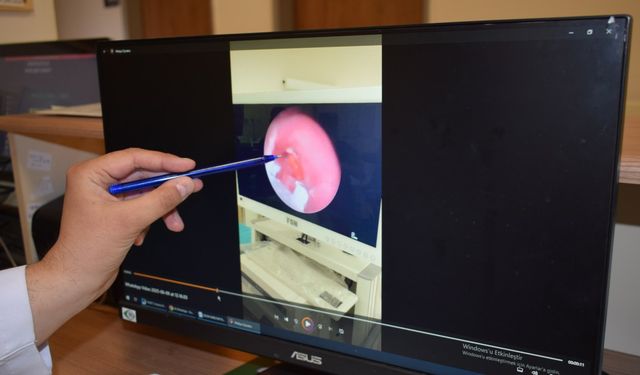 10 Aylık Bebeğin Nefes Borusuna Şeker Ambalajı Kaçtı