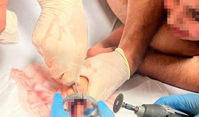 Küçük çocuğun sıkışan parmağını itfaiye kurtardı