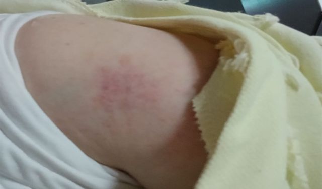 2 Çocuğunu Teslim Etmek İstediği Eski Eşi Tarafından Darbedildi