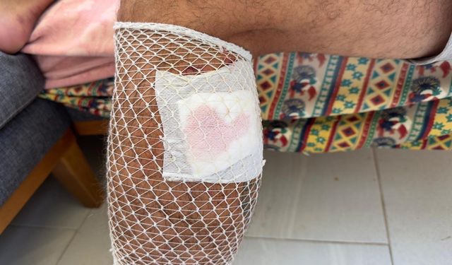 Muğla'da köpek saldırısına uğradı
