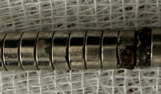 3 Yaşındaki Çocuk 19 Tane Mıknatıs Yuttu