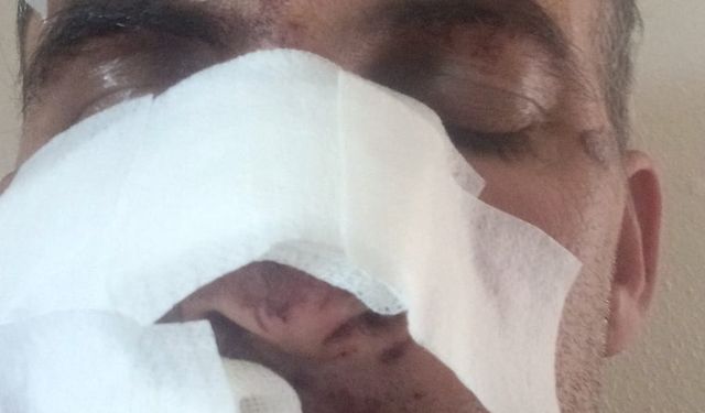 Eniştesine araçla çarpıp kaçtan şahıs tutuklandı