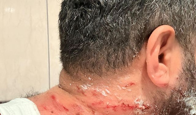 Erzurum'da Tamir Sırasında TIR'ın Sağlam Lastiği Patladı