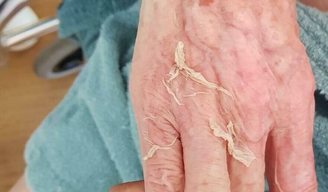 Huzurevinde Ölümde, Doktor Hakkında Yakalama Kararı