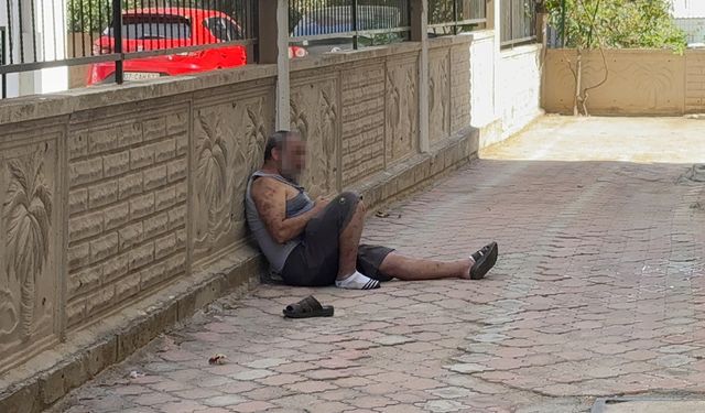 Üzerine Tiner Döktü, Arkadaşı Engelledi