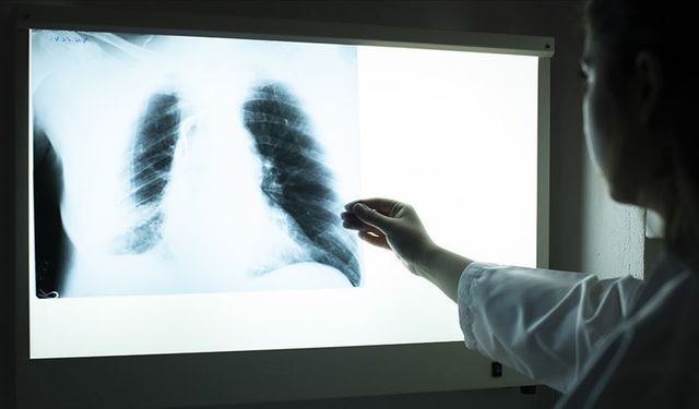 Sigara Kullanan 45 Yaş Üzeri Kişiler Dikkat