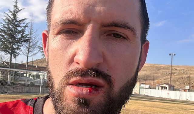 Konya'da amatör ligdeki kavgalı maçta 5 kişi yaralandı