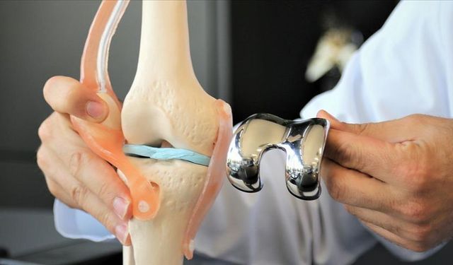 Osteoartrit tedavisinde çığır açan gelişme