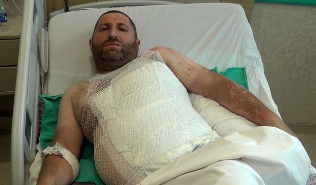 Çalışırken akıma kapılınca vücudunun 3'te 1'i yandı