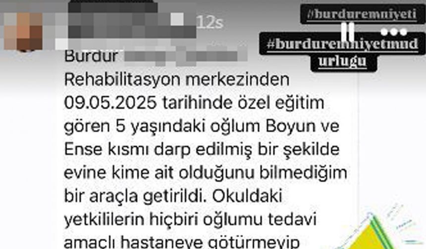 Rehabilitasyon Merkezinde 5 Yaşında Çocuğa Darp İddiası