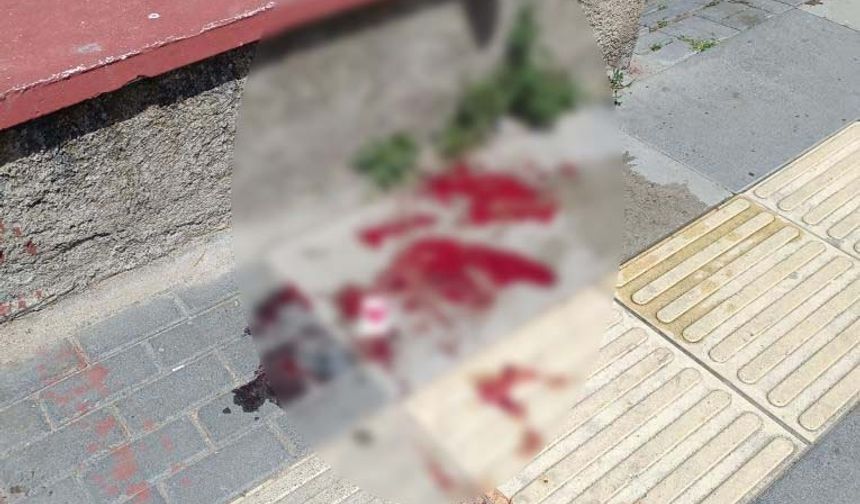 Silahlı Kavgada Yoldan Geçen Kadın Vuruldu