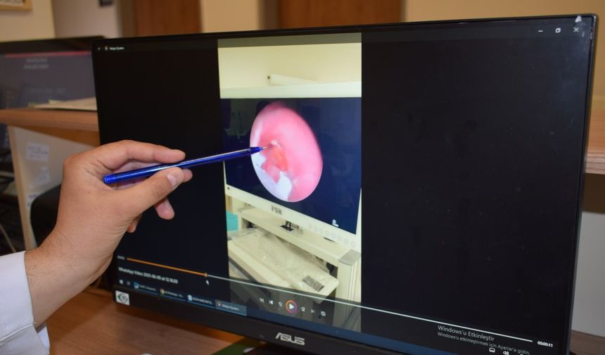 10 Aylık Bebeğin Nefes Borusuna Şeker Ambalajı Kaçtı