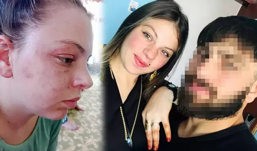 Milli Sporcu Eşinden Şiddet Gören Genç Kadın Konuştu