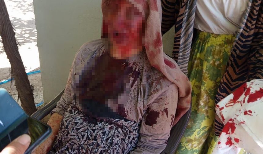 Şanlıurfa’da 85 yaşındaki annesine sopayla saldırdı