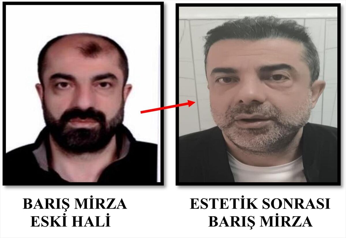 Ameliyat ile yüzünü değiştiren firari yakalandı!